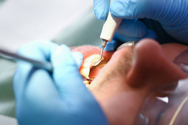 Best Weekend Emergency Dentist in Lansing, KS
