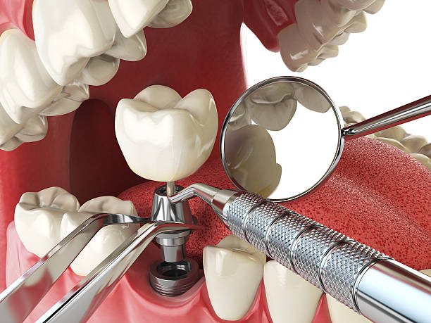Best Mobile Emergency Dentist in Lansing, KS