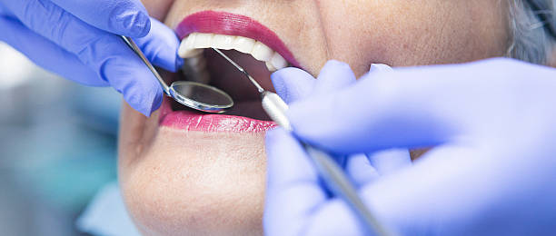 Best Emergency Dentist for Special Needs Patients in Lansing, KS