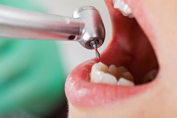 Best Emergency Dentist for Knocked-Out Tooth in Lansing, KS